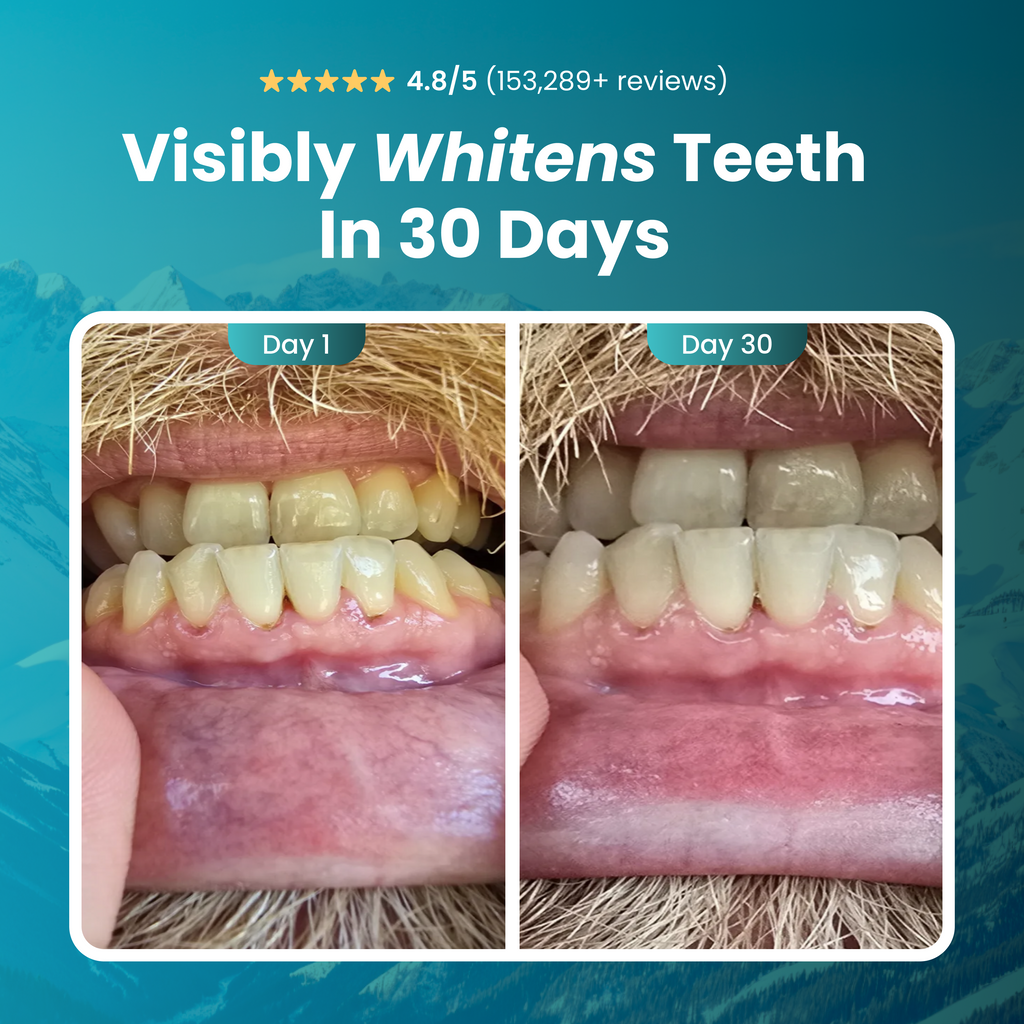 Larineco™️ - Remineralizing Gum